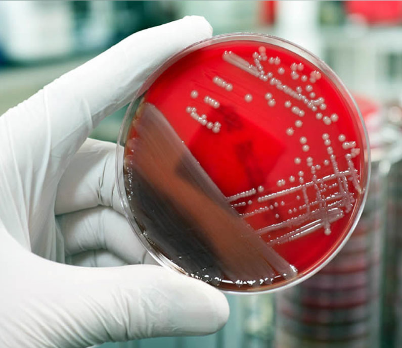 Estudio de vida util carcasa de pollo